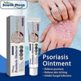 thumbnail image 2 of Anti-itch Cream for Dry and Itchy Skin, Rash, and Prickly Heat Treatment, T, 2 of 5