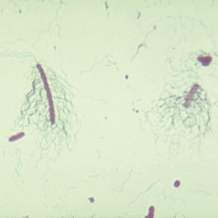 Bacterial Flagella Slide  Peritrichous  W.M. price history on PriceWatchPro