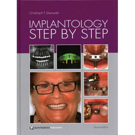 UPC: 9781850972815 | Implantology Step by Step