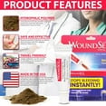 Wound Seal First Aid Care Powder for Minor External Wounds, Stops