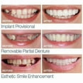 thumbnail image 2 of Smile Snap On False Teeth Upper Lower Dental Veneers Dentures Tooth Cover Setyj51-3, 2 of 5