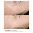 thumbnail image 3 of Aceite Dermalogica Retinol Clearing con Lípidos Fitoactivos 30mL, 3 of 6