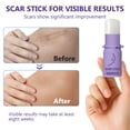 thumbnail image 3 of Keloid Bump Removal, Silicone Scar Stick, Silicone Scar Gel for Keloid Scar Treatment, Acne Scar Treatment, and Scar Cream for Surgical Scars, 3 of 9