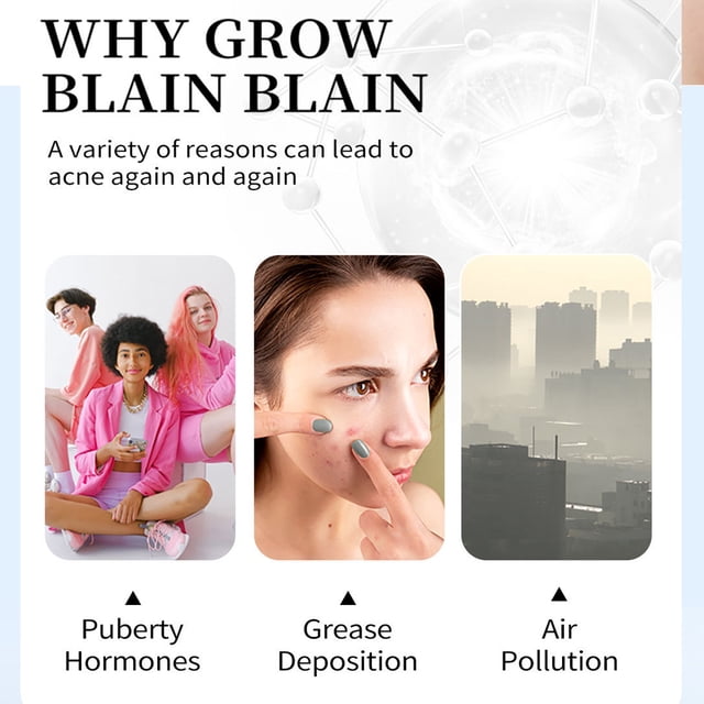 Crema Para El Acné, Antimanchas, Cicatriz De Acné, Eliminación De Espinillas, Crema Para Reducir Los Poros, Blanqueamiento, Hidratante, Cuidado De La Piel Facial ANGGREK Otros