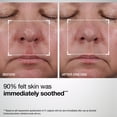 thumbnail image 3 of Barrier Restore+ Soothing Ceramide Cream, 1.7 fl oz, 3 of 10
