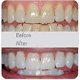 thumbnail image 4 of Cepillo de Dientes Eléctrico - Ultrasónico en Forma de U - Limpieza Bucal 360° - Carga Inalámbrica y Luz LED - Ipx7 Resistente al Agua (Negro), 4 of 5