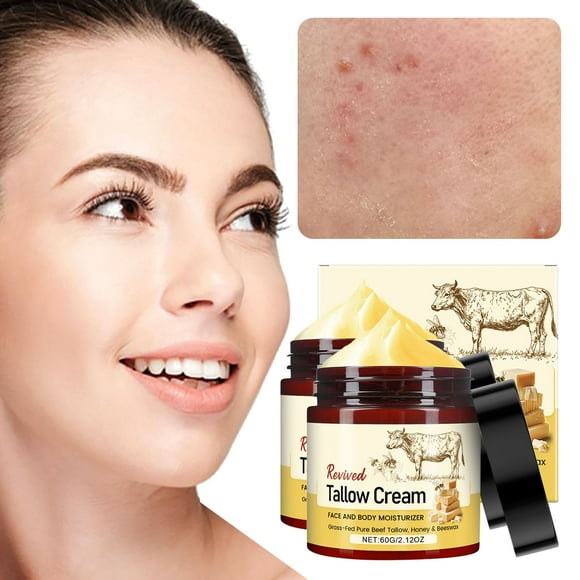 Beef Tallow for Skin Tallow and Honey Cream Face Moisturizer Hydrating Beef Tallow Balm for Body Skin Care