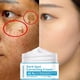 thumbnail image 1 of Repara las manchas oscuras faciales Mejora rápidamente el rostro en 28 días Hidrata y protege la piel de forma inofensiva-niubi, 1 of 5