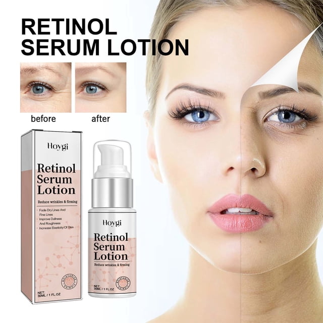 Loción facial con retinol | Sérum hidratante anti-envejecimiento | Fórmula hidratante con retinol | Suaviza líneas finas y arrugas | Uniformiza el tono de piel | Para todo tipo de piel | 30 ml