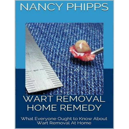 Wart Removal Home Remedy: What Everyone Ought to Know About Wart Removal At Home -