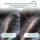 thumbnail image 3 of Seborrheic Dermatitis Psoriasis Shampoo-Refreshing, anti-dandruff, anti-itching and firm hair, 3 of 4