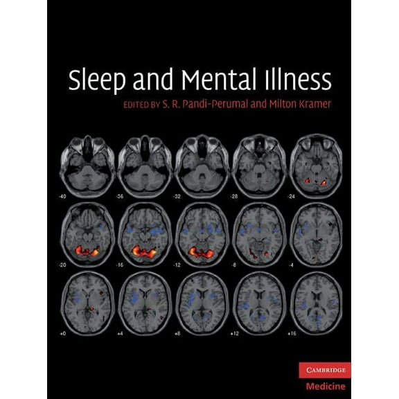 Cambridge Medicine (Hardcover) Sleep and Mental Illness, (Hardcover)
