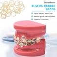thumbnail image 4 of Heavy Rubber Bands For Braces - 1/4 Fox Elastics (100 Pieces), 4 of 4