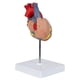 thumbnail image 2 of Heart Model, 2-part Deluxe Life Size Human Heart Replica With 34 Anatomical Structures, Includes Mo, 2 of 5