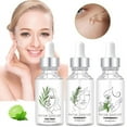 thumbnail image 2 of Esencias faciales de suero de abeja, juego de esencias de menta, árbol de té y romero, 3 piezas (3 x 30 ml), esencias para la piel para cerrar los poros, 2 of 9