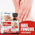 thumbnail image 2 of Aceite para el cuidado de las uñas,CAIXIN solución de tratamiento de uñas 30ml detiene las infecciones por hongos en las uñas para hombres y mujeres, 2 of 6