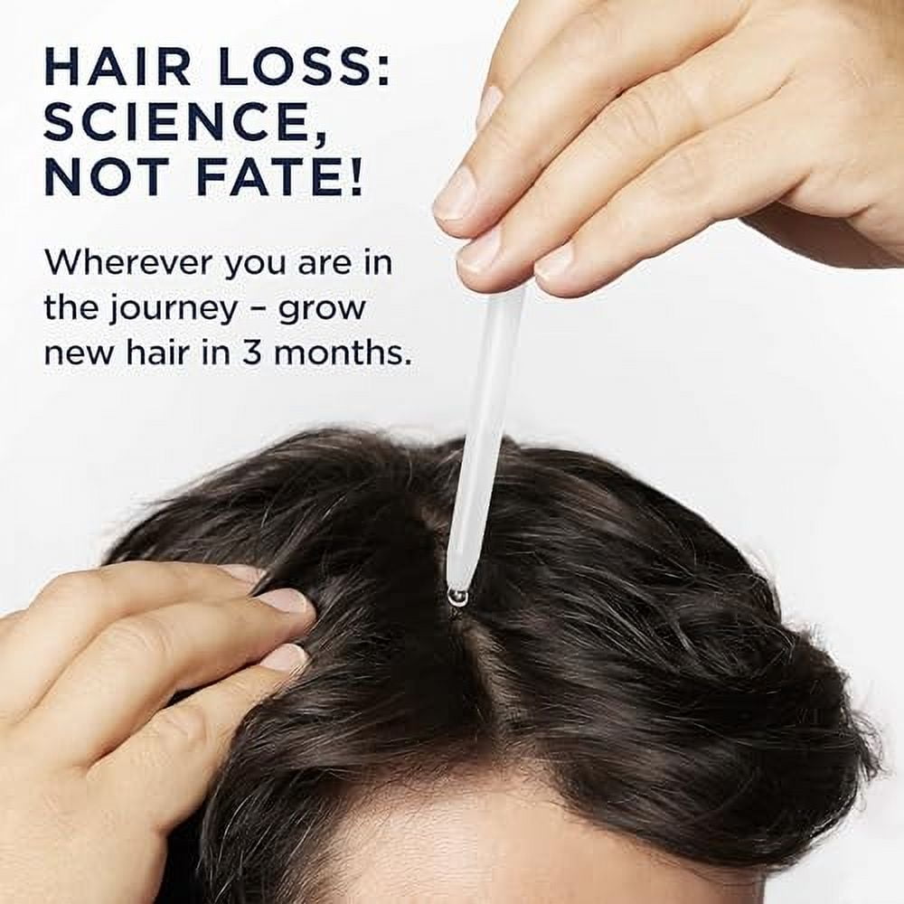 Head & Shoulders Scalp X 5% Minoxidil Hair Regrowth 2x Daily Leave-On Treatment for Men's Thinning Hair & Hair Loss, 3-Month Supply, 2 Fl Oz Each, (Set of 3)
