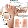 thumbnail image 3 of Foot Callus Removal Spray, Foot Heel Callus Remover Spray, Foot Peel Spray, 3 of 5