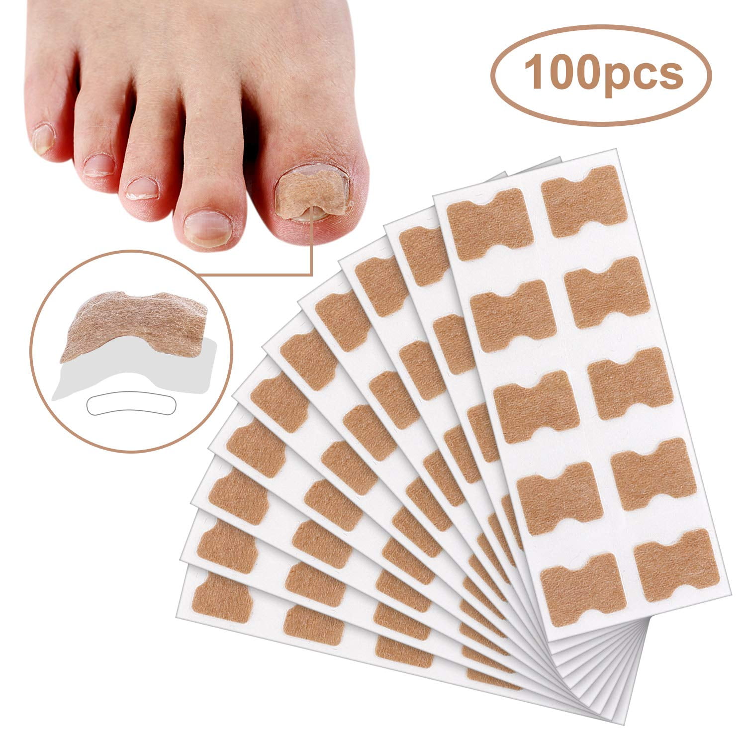 Madholly 100pcs Glue Free Toenail Patch 10 Sheets Ingrown Toenail