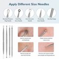 thumbnail image 2 of Blackhead remover lumps Popper tool kit with diagonal tweezers, 2 of 7