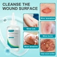 thumbnail image 2 of Limpiador de heridas Dimora Skin & Wound, 237 ml, antiséptico de venta libre, 2 of 9