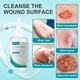thumbnail image 2 of Limpiador de heridas Dimora Skin & Wound, 237 ml, antiséptico de venta libre, 2 of 9