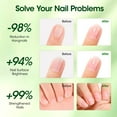 thumbnail image 5 of Gellen Organic Nail Cuticle Oil for Nails Strength, 10ml 0.33 Fl.Oz Ball Type Fingernail Nourishing Oil for Hydrating, Moisturizing, Strengthening, 5 of 10