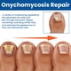 thumbnail image 2 of 60 Uds Pegatinas para Reparación Uñas Parches Transpirables Herramientas Pegajosas El Cuidado Los Pies, 2 of 9