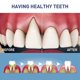 thumbnail image 3 of ExquisiteDental treatment gel, dental treatment gel, safe and effective teeth whitening gel, teeth whitening serum pen, plaque removal for sensitive t, 3 of 5