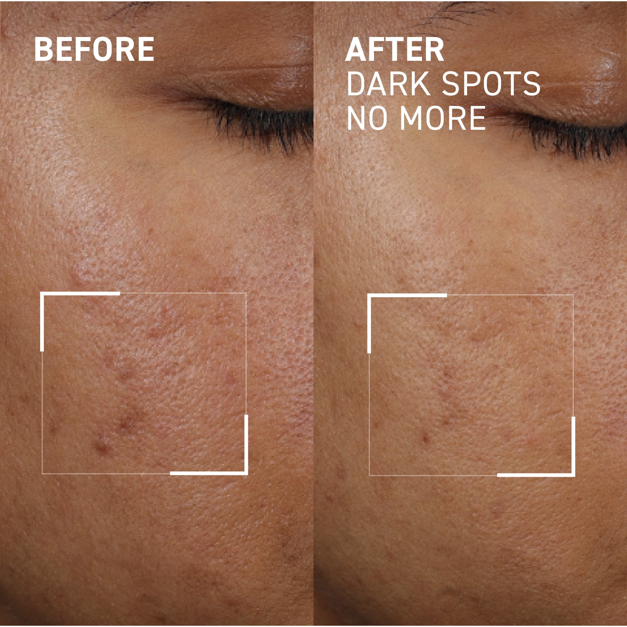 Dr. Brandt Dark Spots No More