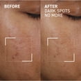 thumbnail image 3 of Dr. Brandt Dark Spots No More, 3 of 6