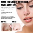 thumbnail image 4 of Masque au Ginseng Transitionnel Masque Pelable Tête Noire au Ginseng 100g Fff, 4 of 5