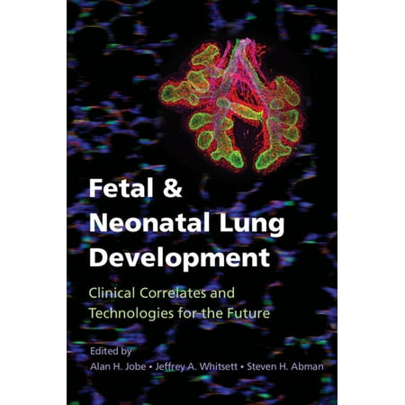 Fetal and Neonatal Lung Development - eBook