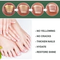 thumbnail image 4 of Nail Fungus Treatment, 50ml Toenail Fungus Treatment, Extra Strong Nail Repair Solution with, 4 of 5