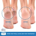 thumbnail image 4 of activelife - Revitaderm 4D Urea Cream Hidrata profundamente para pies secos y agrietados Manos Codos y rodillas Crema ultra reparadora y removedor de callos para pies Sin piedra pómez incluida 4oz 1 p, 4 of 8