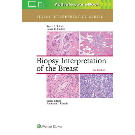 UPC: 9781496365750 | Biopsy Interpretation: Biopsy Interpretation of the Breast (Hardcover)