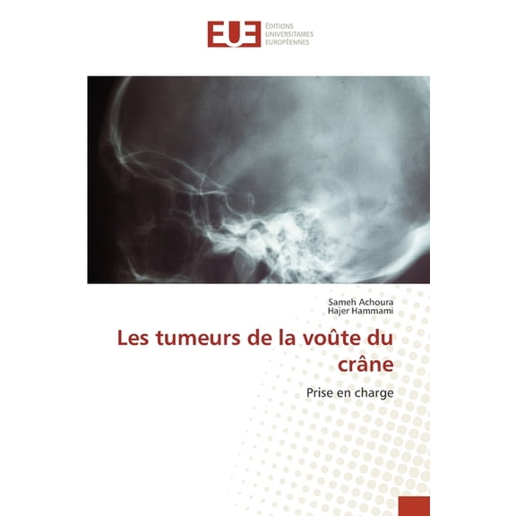 Les tumeurs de la voûte du crâne, (Paperback)