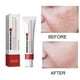 thumbnail image 5 of Crema Para Pecas, Crema Hidratante Reparadora Para Melasma, Manchas Oscuras, Hidratante Yuyangstore Cara Peca Nutritiva, 5 of 8