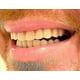 thumbnail image 4 of Instant Smile Comfort Fit Flex Teeth - Upper And Lower Matching Set Natural Shade! Fix Your Smile At Home Within Minutes! JU, 4 of 5