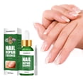 thumbnail image 2 of Xihbxyly Líquido Reparador de Uñas, Tratamiento Nutricional Fortalecedor, Solución Hidratante para El Esmalte, Fórmula para Prevenir La Decoloración, Cuidado de Uñas, Belleza y Manicura, para Mujeres, 2 of 5