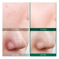 thumbnail image 2 of AHA BHA PHA 30 Days Miracle Starter Set - Some By Mi Original Some By Mi 30 Days, 2 of 6
