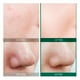 thumbnail image 2 of AHA BHA PHA 30 Days Miracle Starter Set - Some By Mi Original Some By Mi 30 Days, 2 of 6
