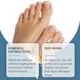 thumbnail image 3 of Nail Fungas Treatmet Cream, Nail Care Cream, Fungal Nail Treatment for Toenails Extra Strong, Improves Nail Appearance & Nail Repair Solution, Nourish, 3 of 5