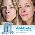 thumbnail image 2 of Rodillo de Hielo PLANTIFIQUE de Acero Inoxidable para Enfriamiento Facial, 2 of 7