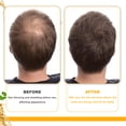 thumbnail image 4 of Biotin dense hair essential oil, 4 of 4