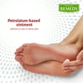thumbnail image 5 of Medline Remedy Essentials Athlete's Foot Antifungal Cream with Zinc Oxide, 4 oz., 5 of 6