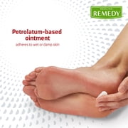 Medline Remedy Essentials Athletes Foot Antifungal Cream with Zinc Oxide, 4 oz.