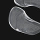 thumbnail image 3 of EeaseMX 3 pares de plantillas ortopédicas de apoyo para el arco del pie, almohadillas para zapatos talla S (transparentes), 3 of 7