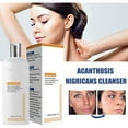 Face Cleansing Lotion For Acanthosis Nigricans & Dark Spots Foaming