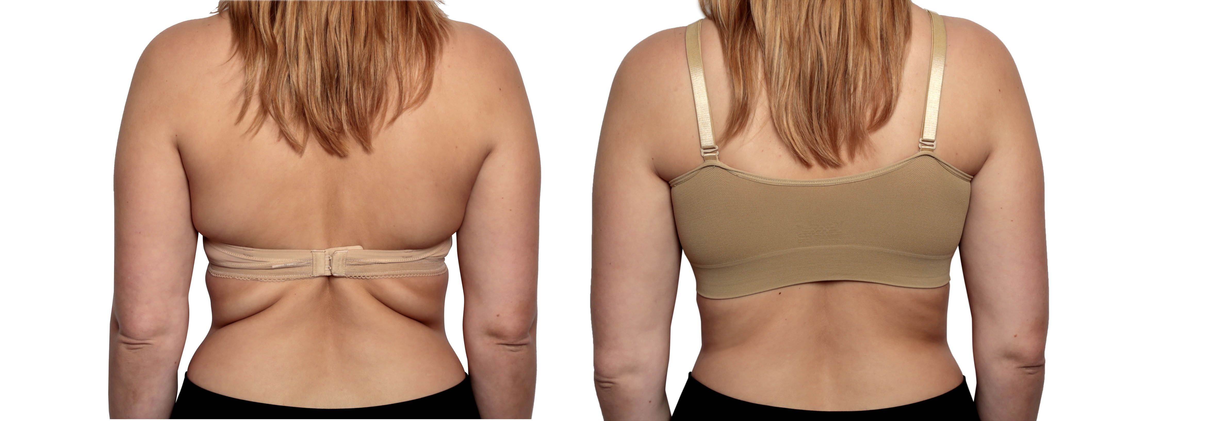 Dream By Genie Bra, Comfortable Bra with Breathable Fabric, Extra Large, As Seen on TV